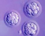 La vita dopo il trasferimento IVF Punti salienti prima dell'analisi hCG: mestruazioni o sanguinamento da impianto