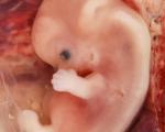 Brytyjskie Ministerstwo Spraw Zagranicznych żąda zastąpienia terminu „kobiety w ciąży” terminem „osoby w ciąży”.