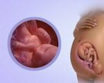 38 Wochen schwanger, starker Druck im Po