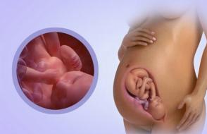 38 Wochen schwanger, starker Druck im Po