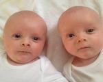 Kuo identiški dvyniai skiriasi nuo brolių dvynių?