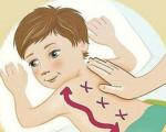Treatment of cough in a child with drainage massage