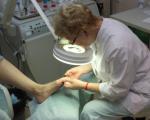 Pėdų onichomikozės gydymo ir profilaktikos metodai